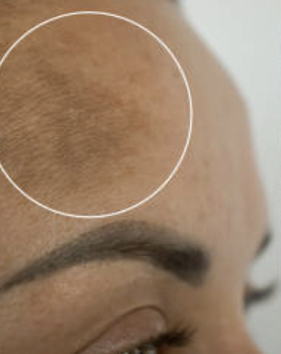 Before treatment 2