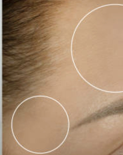 After treatment 2